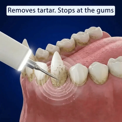Ultrasonic plaque and tartar remover for dogs