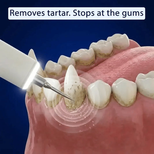 Ultrasonic plaque and tartar remover for dogs